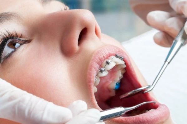 Planos odontológicos